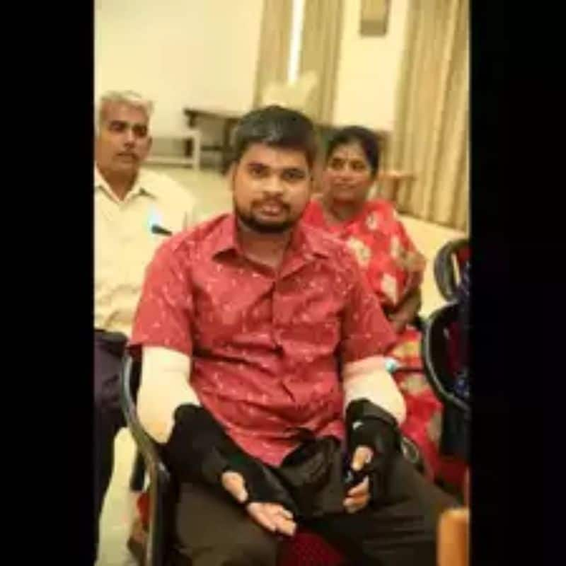 24 year old man successfully undergoes hands transplant in Tamil Nadu hospital