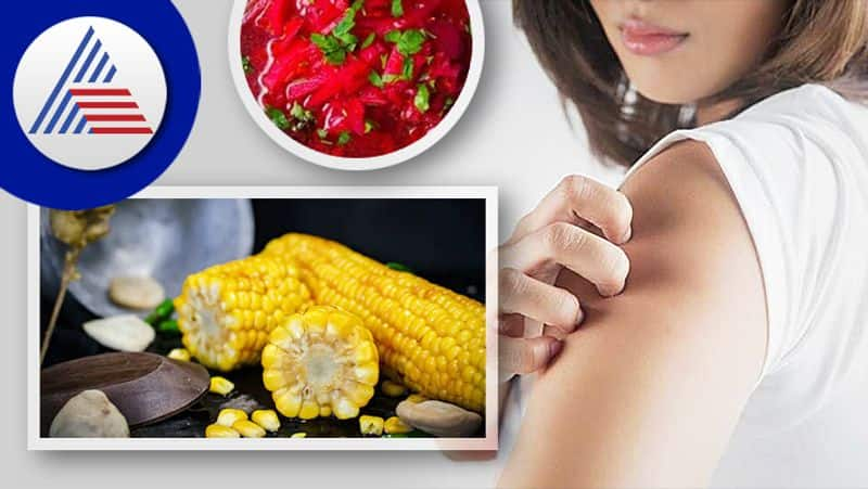 Allergies During Monsoon, Expert Recommends Right Foods To Consume Vin