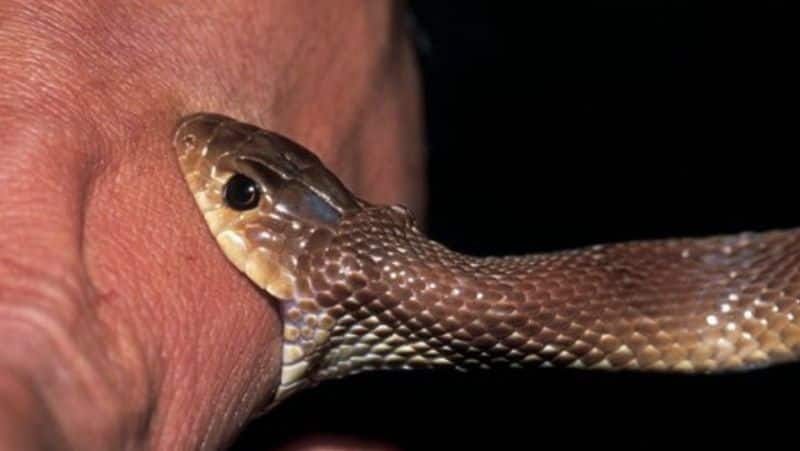 What to Do Immediately After a Snake Bite: Essential First Aid Tips SNS