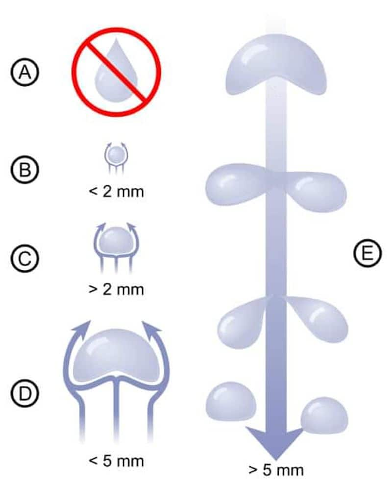 science what is the shape of raindrops  by Thulasy joy 