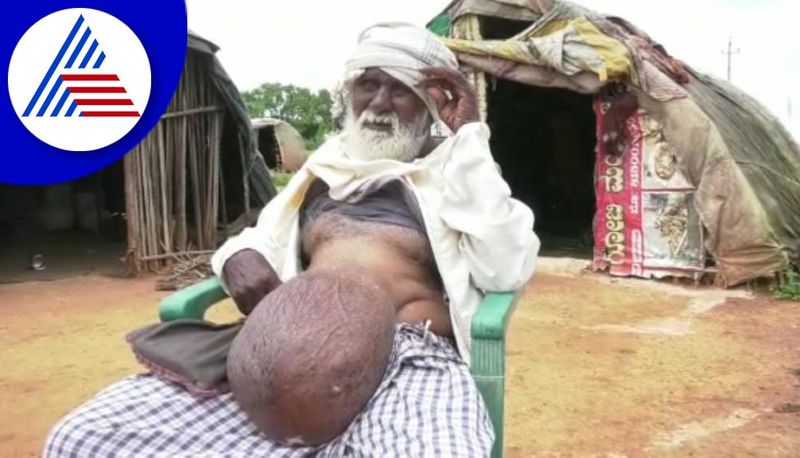 gadag old man seeking fund donor support for stomach surgery gvd