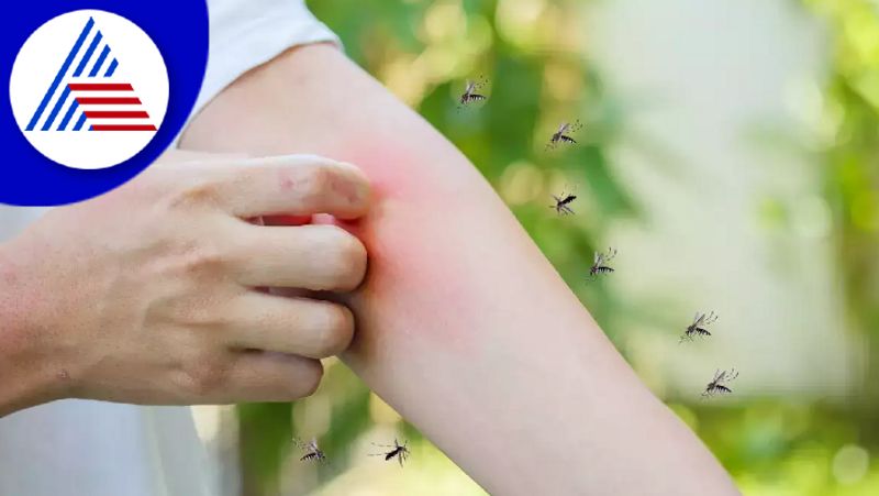 Reasons Why Mosquitoes Bite Some People More rsl