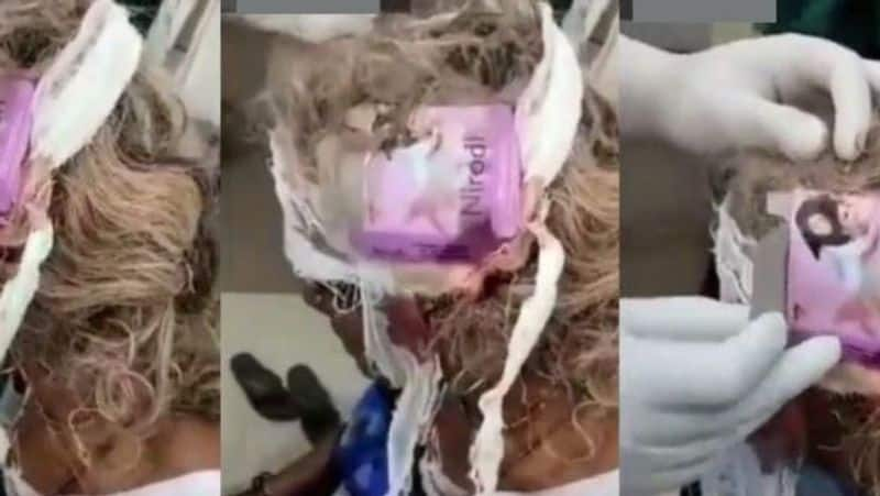 Head Wound Dressed With Condom Pack At Madhya Pradesh Health Centre