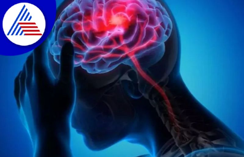 Brain Stroke: Know Its Symptoms, Causes And Prevention Vin