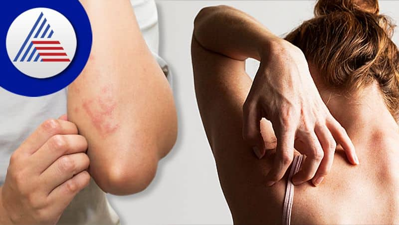 Itchy skin should not be taken lightly can lead to pancreatic cancer