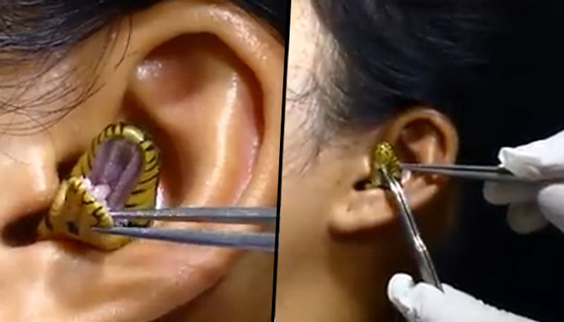 Snake stuck inside woman's ear: viral video stunned netizens - gps