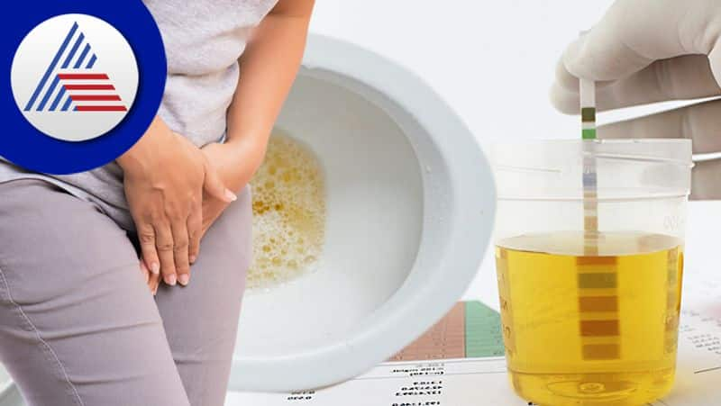 Expert Tips On How To Treat Urine Leakage