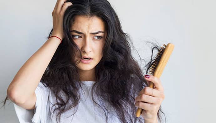 hair fall