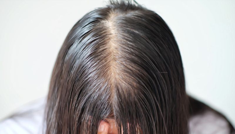 effective solutions to treat hair thinning