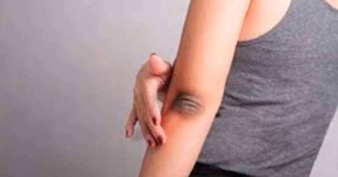 elbow