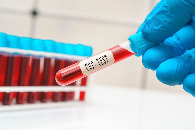 Can blood tests help in indicating a heart attack? Can it determine