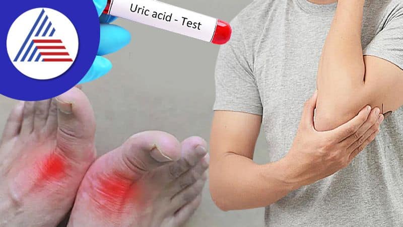 reasons behind the causes for high uric acid levels and tips to reduce it here in tamil mks