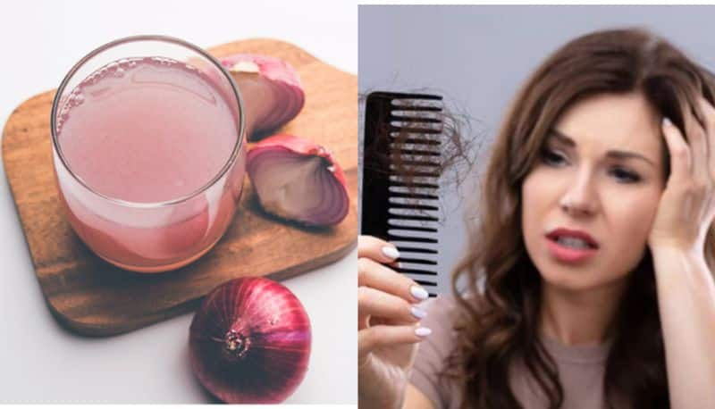 Amazing advantages of using onion hair oil