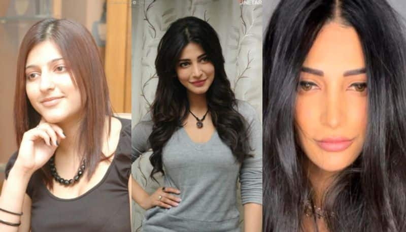 Shruti Haasan On Her Nose Job