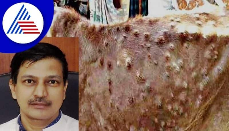 Lumpy skin disease: 960 cases  in a single month at chikkamagauru rav