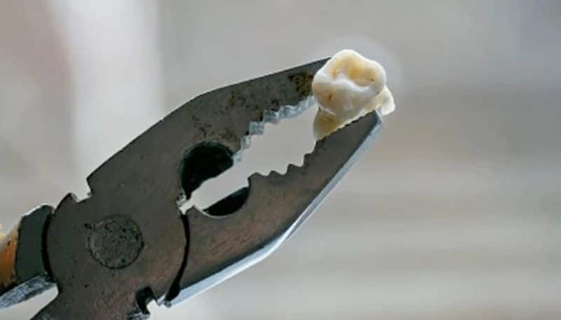 uk man pulls out his own teeth for fifteen years