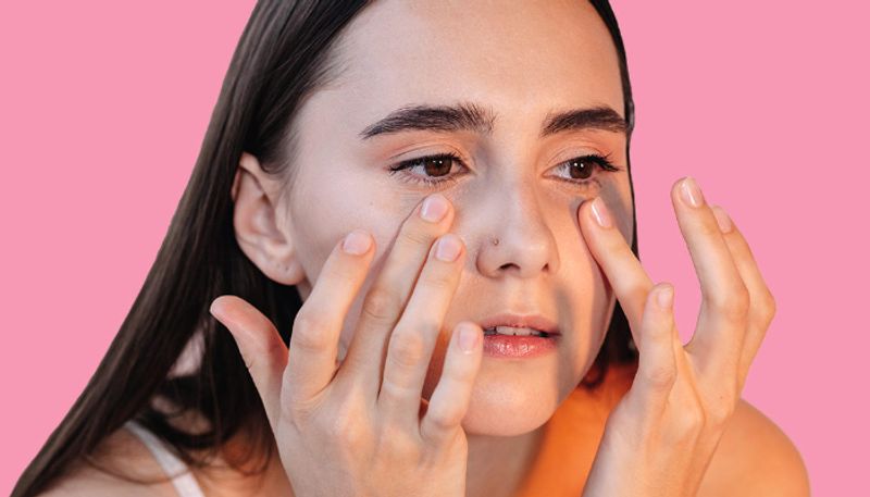 home remedies for dark circles under the eyes azn