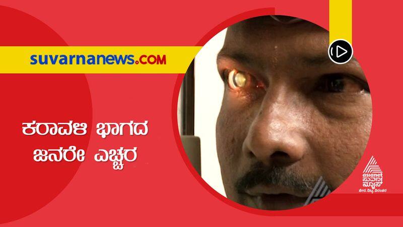 conjunctivitis disease appearing school children in mangalore suh 