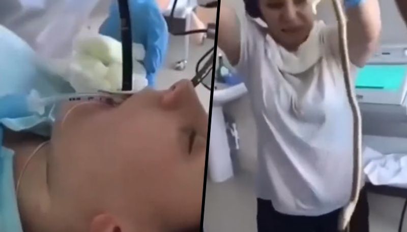 doctors pull out 4 foot snake from womans food pipe, video goes viral