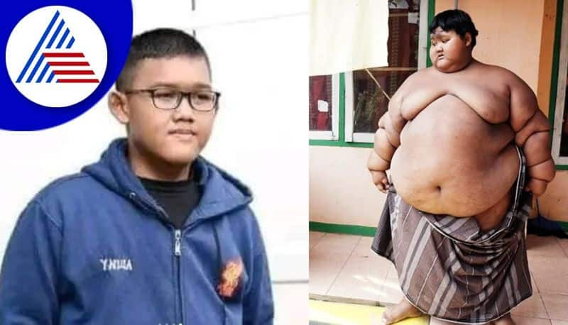 Weight Loss Journey Of Worlds Most Obese Child Aria Permana 