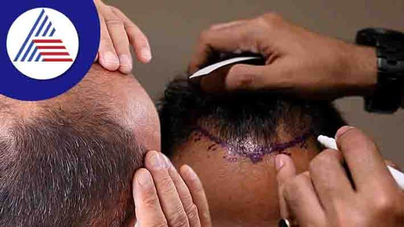 Man Dies Of Sepsis After Hair Transplant Treatment, Are Cosmetic Surgeries Safe Vin