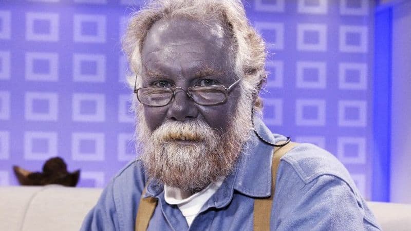 colloidal silver to turn you blue