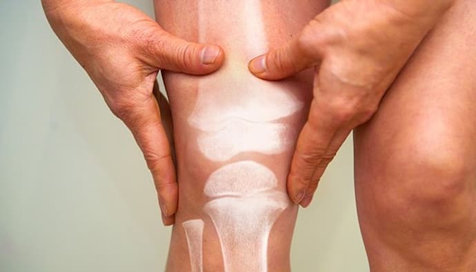 What is Stiff person syndrome? A glance at its causes and symptoms 