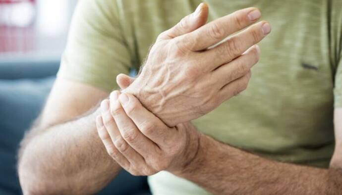 Arthritis