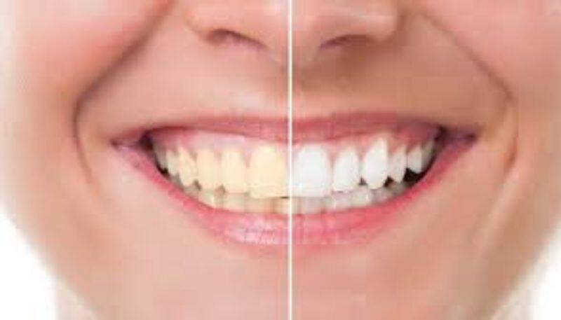 Should you rub your teeth with salt for white teeth