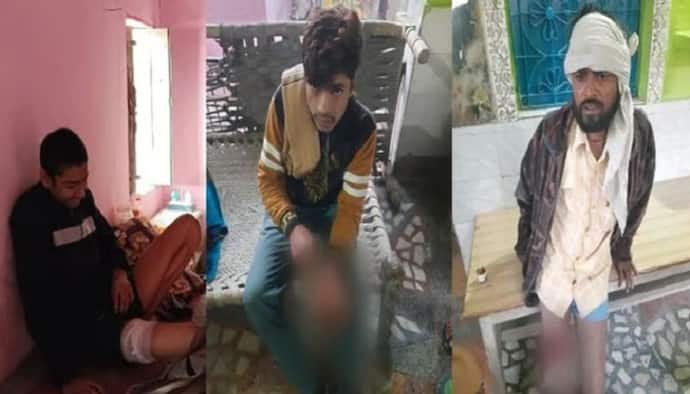 आगरा में एक ही दिन में कुत्ते ने 28 लोगों पर किया हमला, लोगों ने बेजुबान को दी दर्दनाक मौत