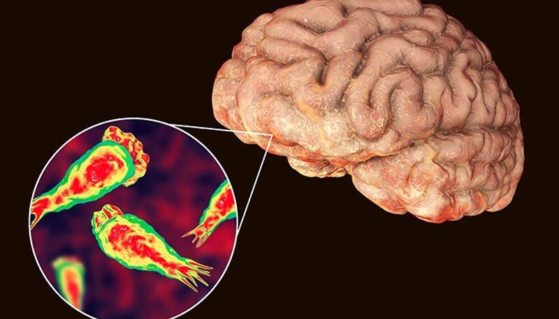 What is Brain-eating amoeba? Know its symptoms, prevention and chances of survival RBA EAI