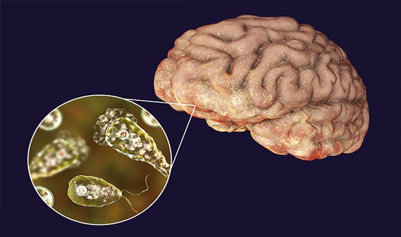 What is Brain-eating amoeba? Know its symptoms, prevention and chances of survival RBA EAI