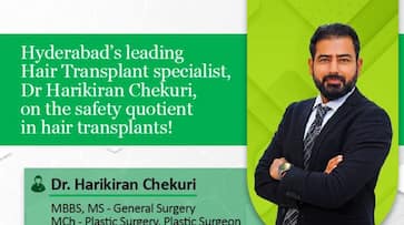 Hyderabads leading specialist, Dr Harikiran Chekuri, on the safety quotient in hair transplants!-vpn