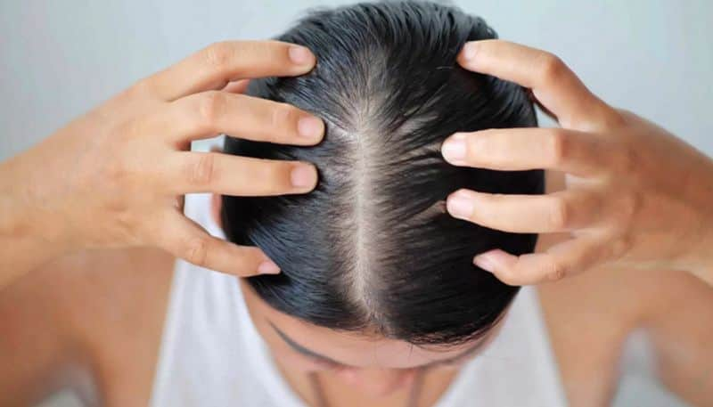 tips to get rid of hair fall