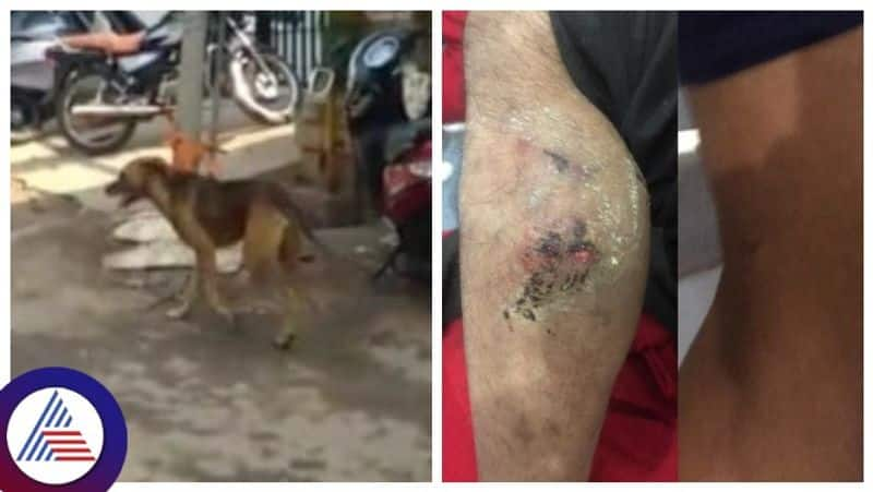 stray dog bite in belagavi people angry against  City Corporation gow