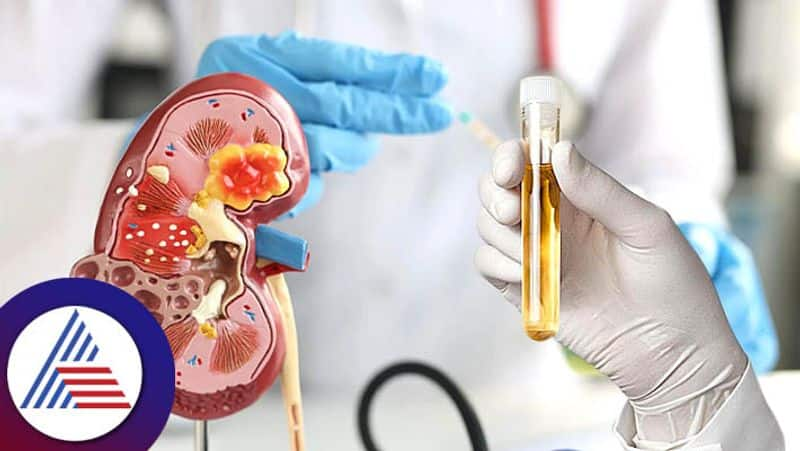 Know about these 3 kidney problems and its symptoms 