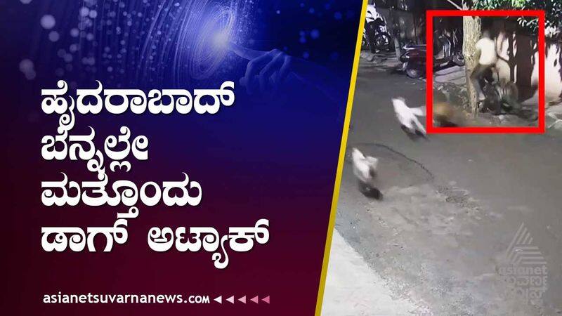 Deadly Dog Attack At JP Park In Bengaluru gvd