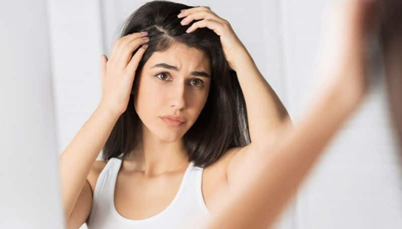 four hair masks to get rid of dandruff azn