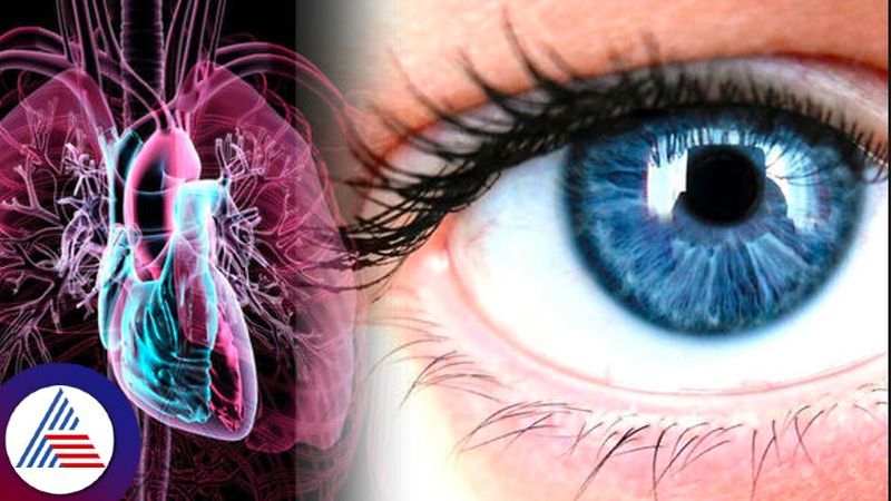 Health tips, Early Signs of Heart Disease Appear in the Eyes Vin