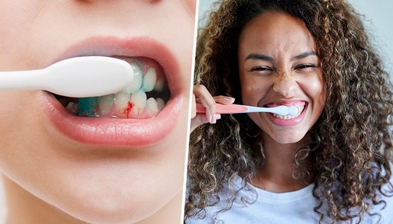 Three crucial oral hygiene habits to avoid bleeding gums and cavities