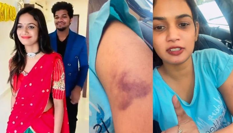 Bigg Boss Beauty Ariyana Glory Injured