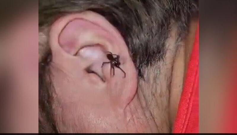 spider crawling out of mans ear the video goes viral hyp