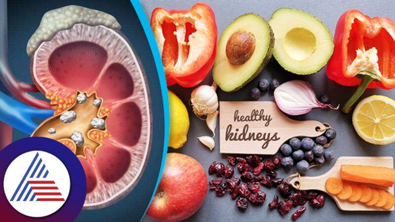 Know best ways and foods to clean your kidney and remove stones naturally