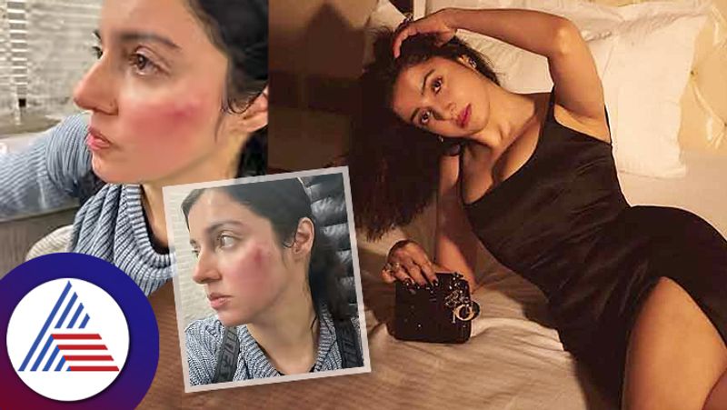 Divya Khosla Kumar says shes badly injured on sets 