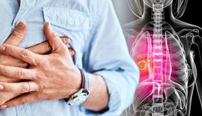 What is the link between asthma and lung cancer? Understanding the connection
