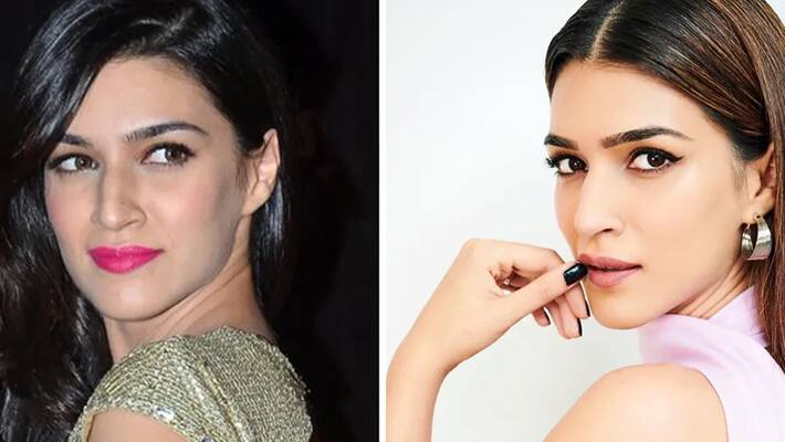 Did Kriti Sanon got a nose job