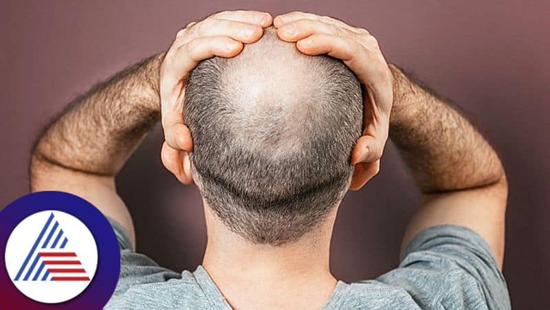 Do Bald Men Make Better Bed Partners, What experts say Vin