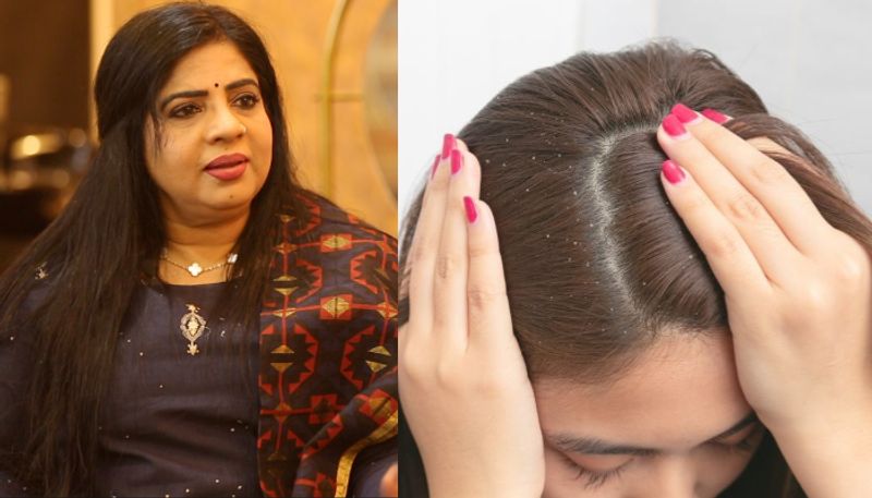 dandruff and hair fall tips by anila joseph azn 