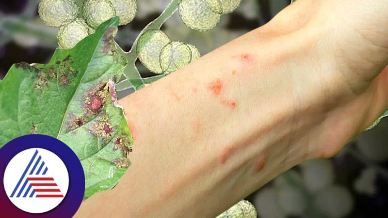 Fungal Disease In Human Falls Victim To Fungus Disease From Plant In Kolkata