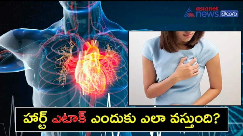 All you need to know about how and why heart attack is caused